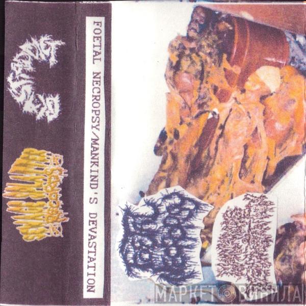 / Foetal Necropsy  Mankind's Devastation  - Foetal Necropsy/Mankind's Devastation Split