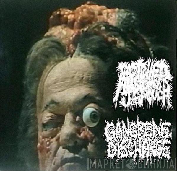 / Botched Anastomosis J-Pouch  Gangrene Discharge  - Split