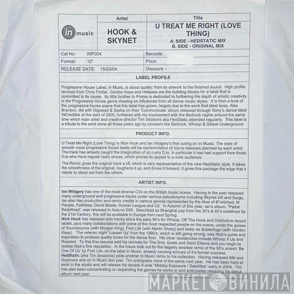 & Skynet UK  Hook   - U Treat Me Right