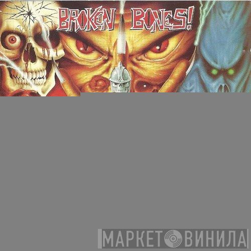  Broken Bones  - Losing Control