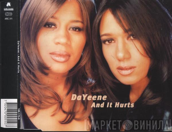  DaYeene  - And It Hurts