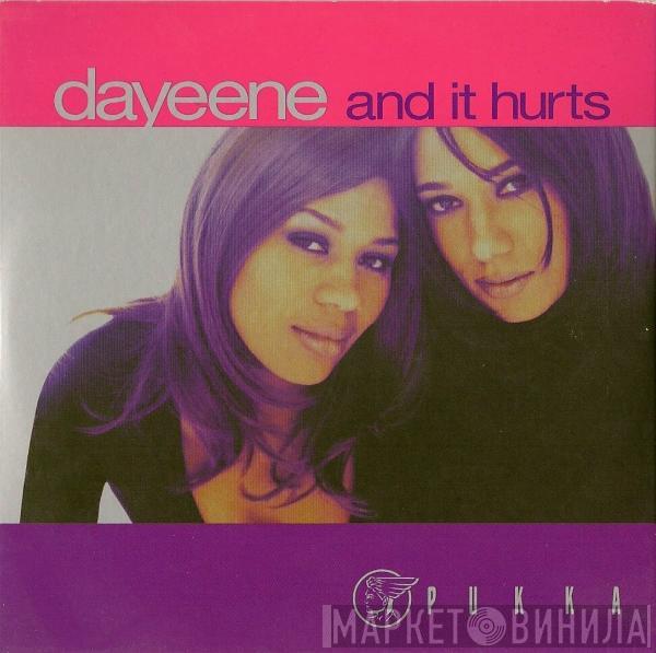 DaYeene - And It Hurts