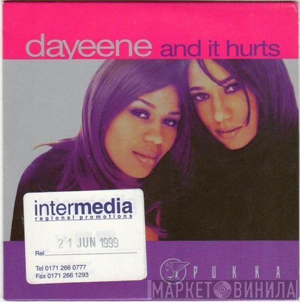 DaYeene - And It Hurts