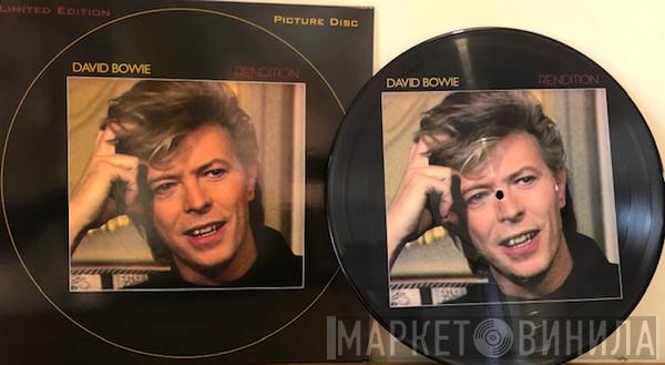David Bowie - Rendition