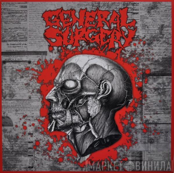 General Surgery Butcher ABC  - General Surgery / Butcher ABC