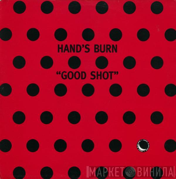 Hand's Burn - Good Shot