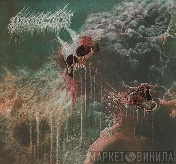  - Hierarchies