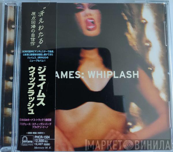  James  - Whiplash
