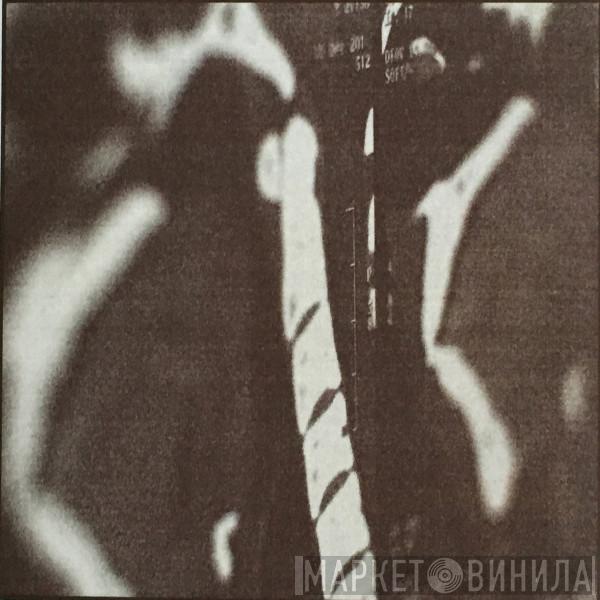  Norman Westberg  - MRI