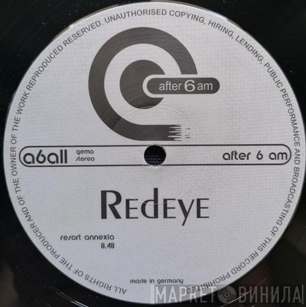 Redeye - Resort Annexia