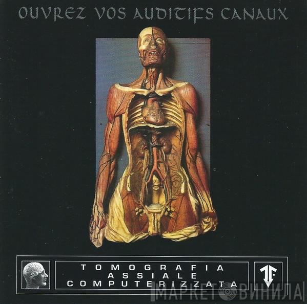  Tomografia Assiale Computerizzata  - Ouvrez Vos Auditifs Canaux