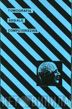  Tomografia Assiale Computerizzata  - Senza Titolo