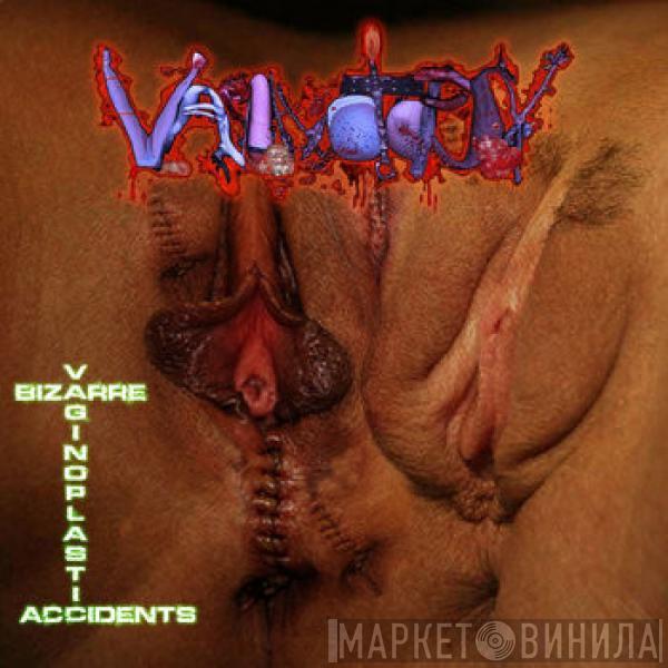  Vaginotopsy  - Bizarre Vaginoplastic Accidents